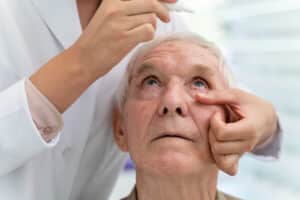 patient receiving eye drops to check for cataracts